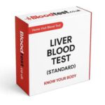 Essentials of Liver Blood Tests for Residents in Guildford