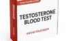 Testosterone Blood Test Expectations in Middlesbrough